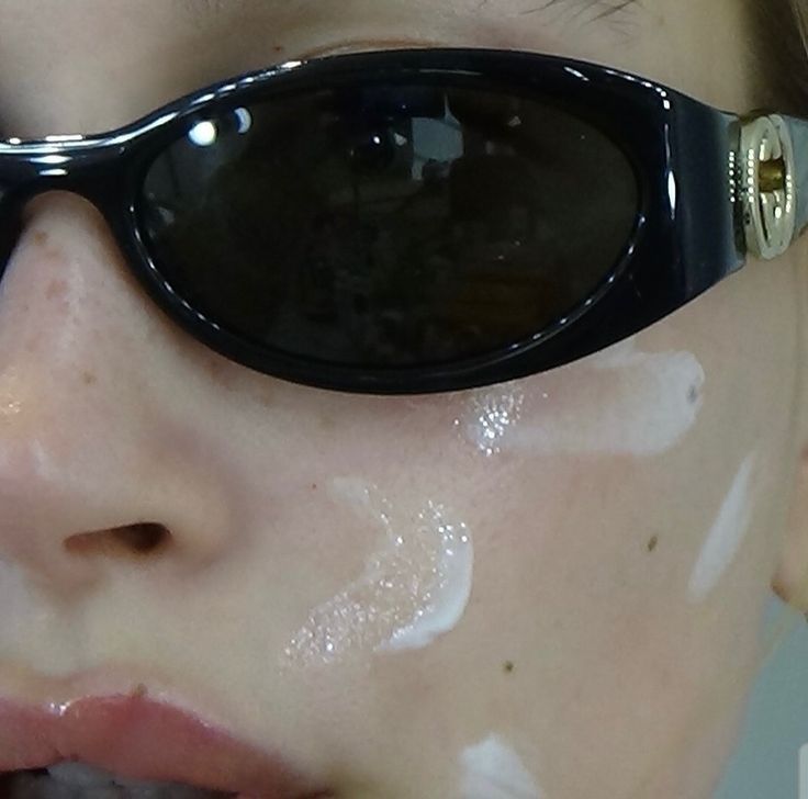 What Sugar Actually Does to Your Skin (And Why It Shows Up on Your&nbsp;Face)
